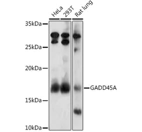 Western Blot - Anti-GADD45A Antibody (A13662) - Antibodies.com