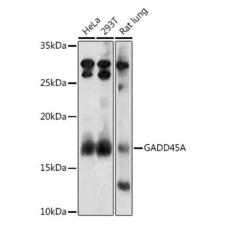 Western Blot - Anti-GADD45A Antibody (A13662) - Antibodies.com