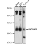 Western Blot - Anti-GADD45A Antibody (A13662) - Antibodies.com