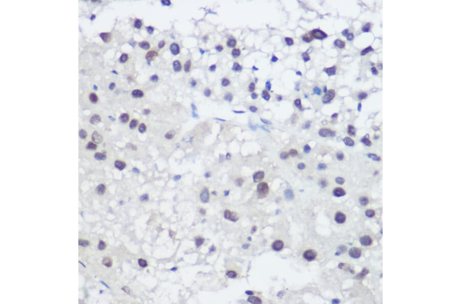 Immunohistochemistry - Anti-GADD45A Antibody (A13662) - Antibodies.com