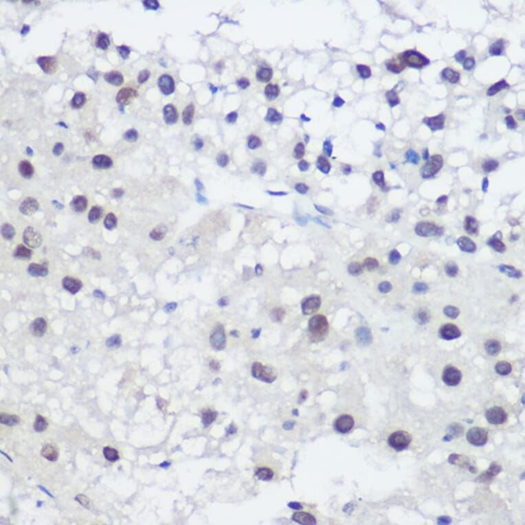 Immunohistochemistry - Anti-GADD45A Antibody (A13662) - Antibodies.com