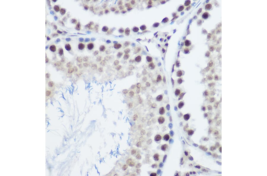 Immunohistochemistry - Anti-GADD45A Antibody (A13662) - Antibodies.com