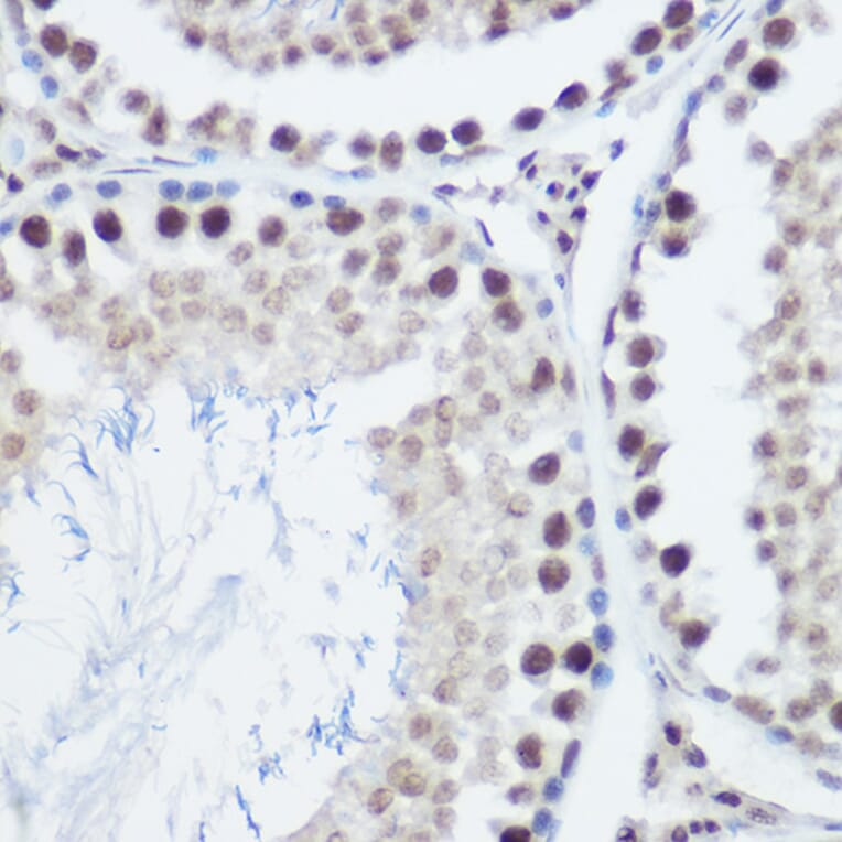 Immunohistochemistry - Anti-GADD45A Antibody (A13662) - Antibodies.com