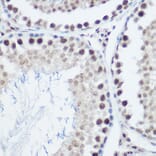 Immunohistochemistry - Anti-GADD45A Antibody (A13662) - Antibodies.com