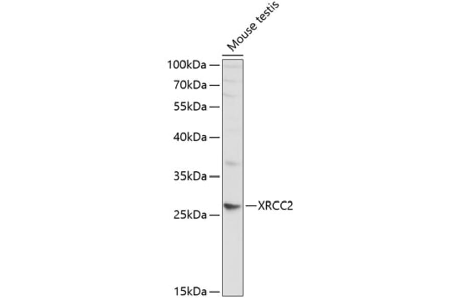 Western Blot - Anti-XRCC2 Antibody (A1800) - Antibodies.com