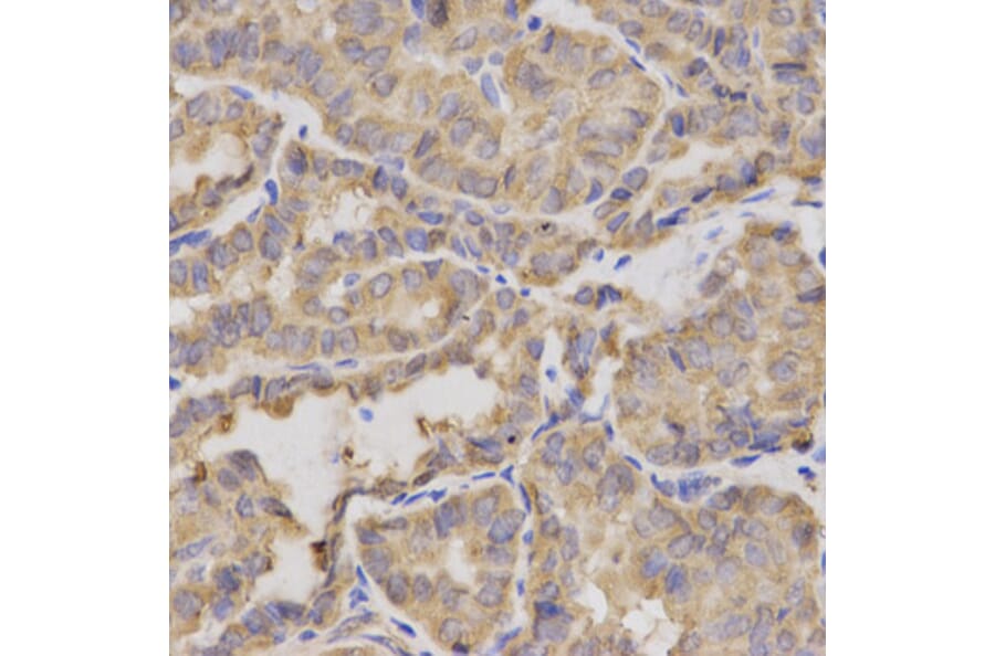 Immunohistochemistry - Anti-XRCC2 Antibody (A1800) - Antibodies.com