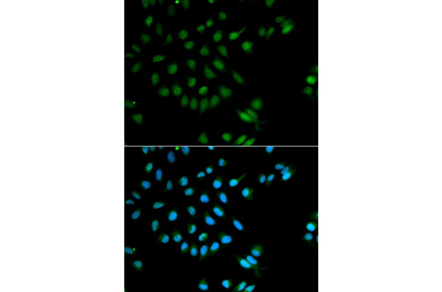 Immunofluorescence - Anti-XRCC2 Antibody (A1800) - Antibodies.com