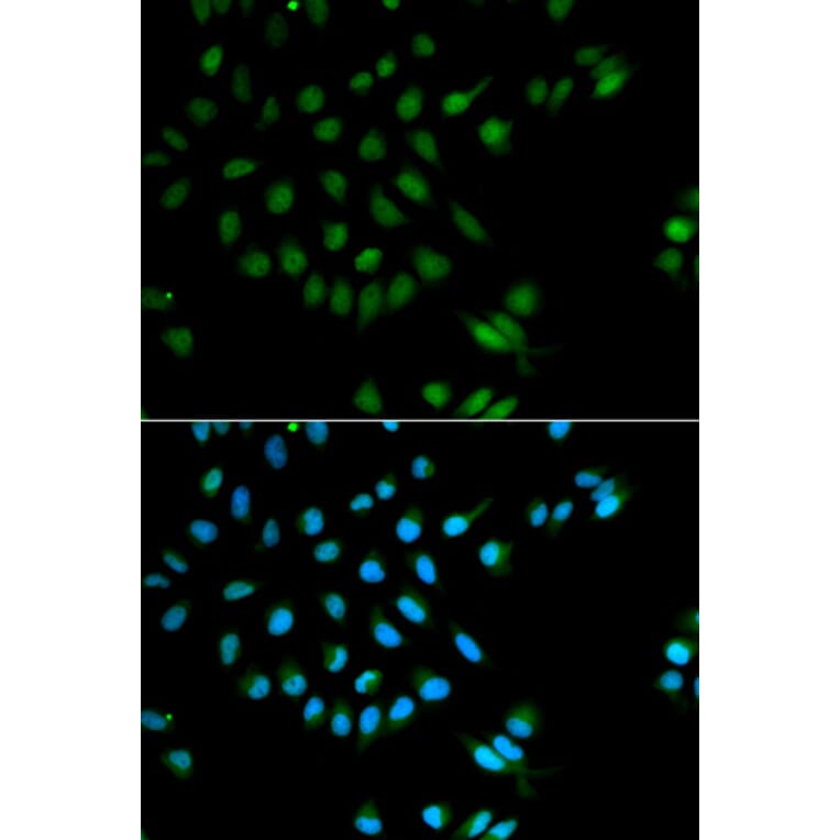 Immunofluorescence - Anti-XRCC2 Antibody (A1800) - Antibodies.com