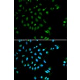 Immunofluorescence - Anti-XRCC2 Antibody (A1800) - Antibodies.com