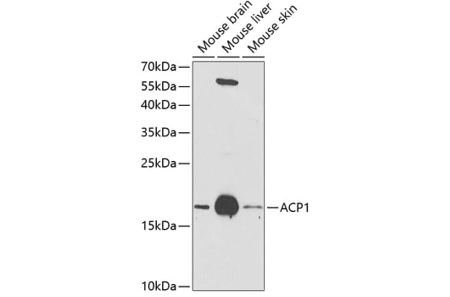 Western Blot - Anti-Acid phosphatase/ACP1 Antibody (A13665) - Antibodies.com