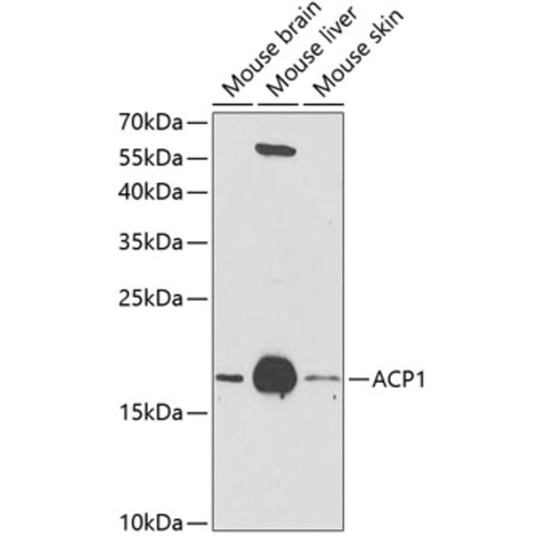 Western Blot - Anti-Acid phosphatase/ACP1 Antibody (A13665) - Antibodies.com
