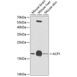 Western Blot - Anti-Acid phosphatase/ACP1 Antibody (A13665) - Antibodies.com
