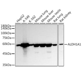 Western Blot - Anti-ALDH1A1 Antibody (A13666) - Antibodies.com