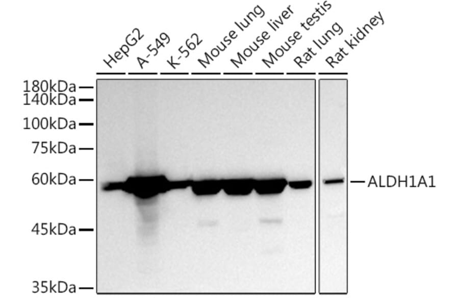 Western Blot - Anti-ALDH1A1 Antibody (A13666) - Antibodies.com