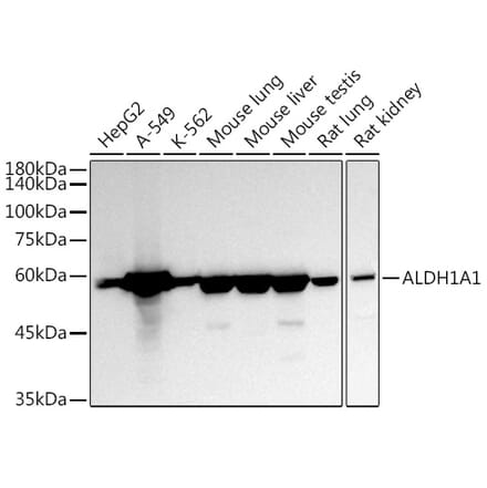 Western Blot - Anti-ALDH1A1 Antibody (A13666) - Antibodies.com