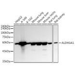 Western Blot - Anti-ALDH1A1 Antibody (A13666) - Antibodies.com