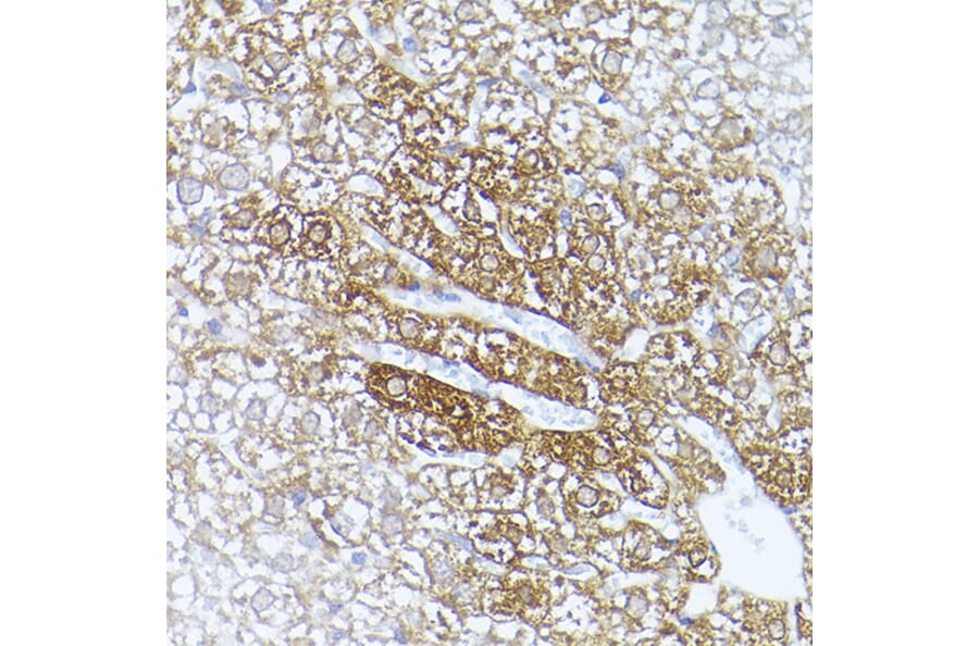 Immunohistochemistry - Anti-ALDH1A1 Antibody (A13666) - Antibodies.com