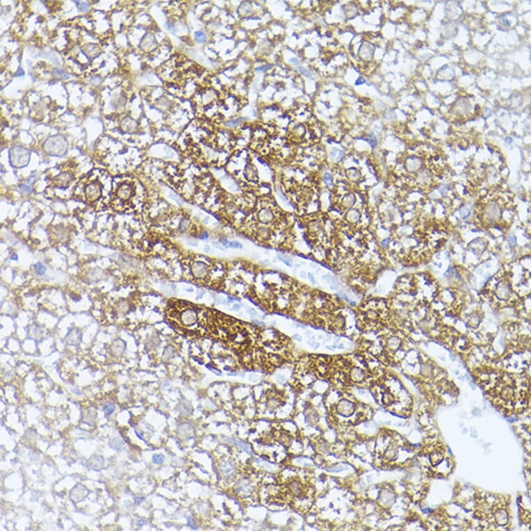 Immunohistochemistry - Anti-ALDH1A1 Antibody (A13666) - Antibodies.com