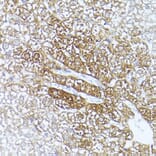 Immunohistochemistry - Anti-ALDH1A1 Antibody (A13666) - Antibodies.com