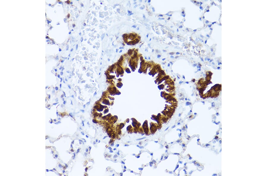 Immunohistochemistry - Anti-ALDH1A1 Antibody (A13666) - Antibodies.com