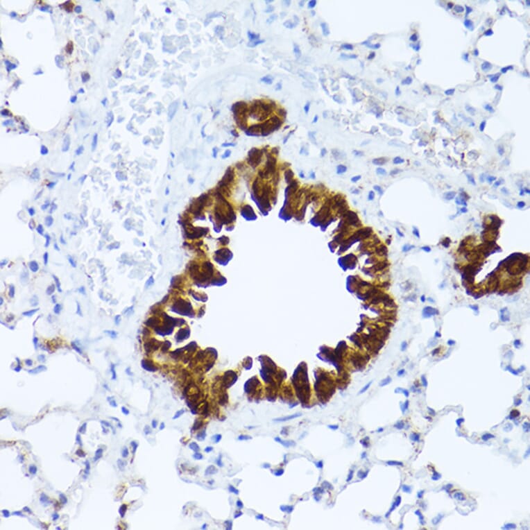 Immunohistochemistry - Anti-ALDH1A1 Antibody (A13666) - Antibodies.com