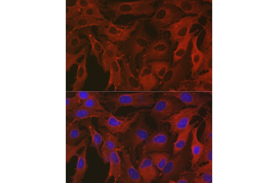 Immunofluorescence - Anti-ALDH1A1 Antibody (A13666) - Antibodies.com