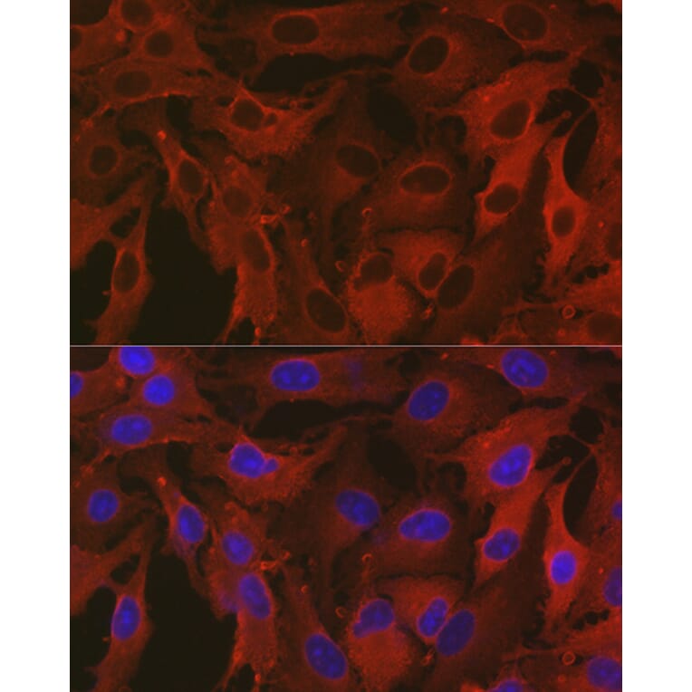 Immunofluorescence - Anti-ALDH1A1 Antibody (A13666) - Antibodies.com