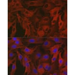 Immunofluorescence - Anti-ALDH1A1 Antibody (A13666) - Antibodies.com