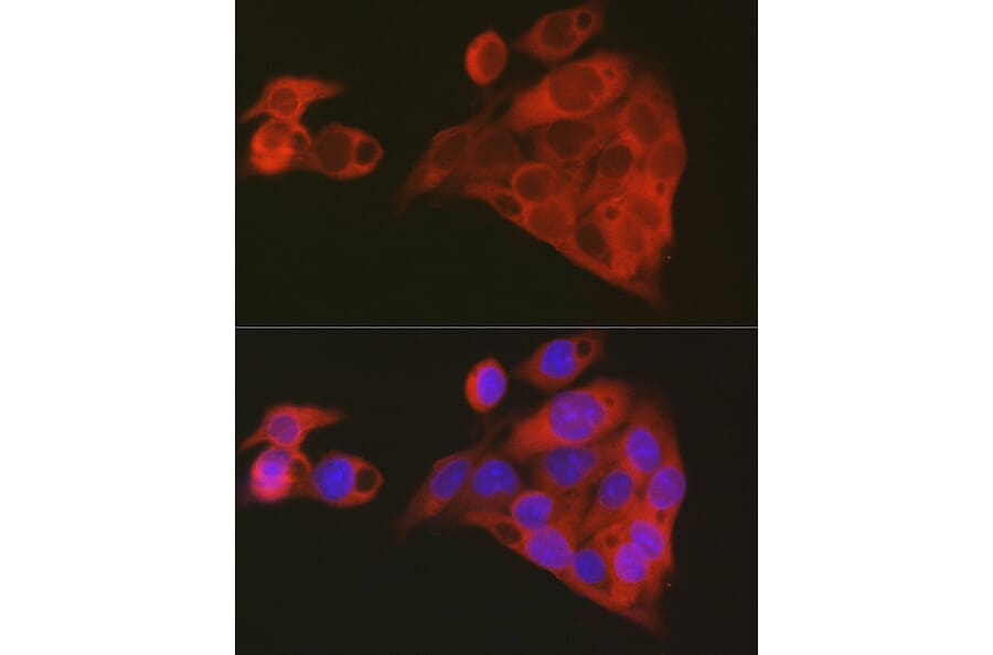 IF - Anti-ALDH1A1 Antibody (A13666)