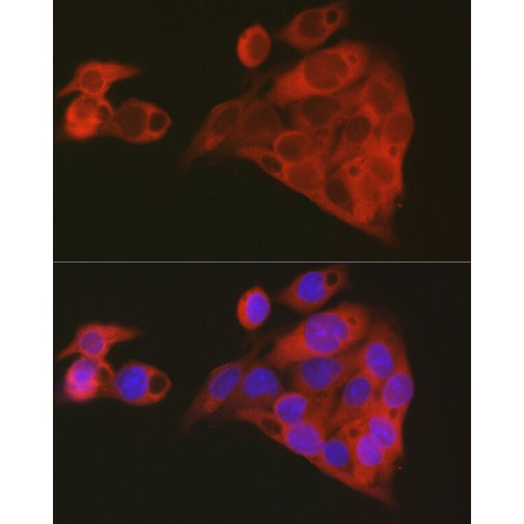 Immunofluorescence - Anti-ALDH1A1 Antibody (A13666) - Antibodies.com