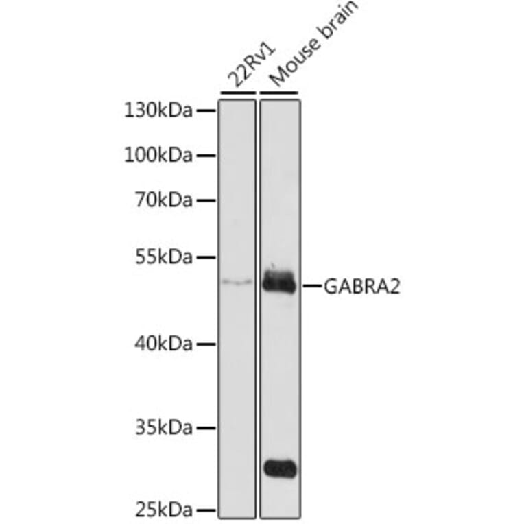 Western Blot - Anti-GABA A Receptor alpha 2/GABRA2 Antibody (A13667) - Antibodies.com