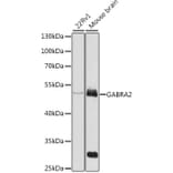 Western Blot - Anti-GABA A Receptor alpha 2/GABRA2 Antibody (A13667) - Antibodies.com