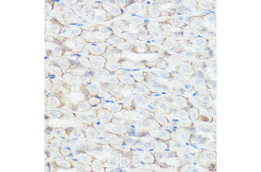 Immunohistochemistry - Anti-GABA A Receptor alpha 2/GABRA2 Antibody (A13667) - Antibodies.com