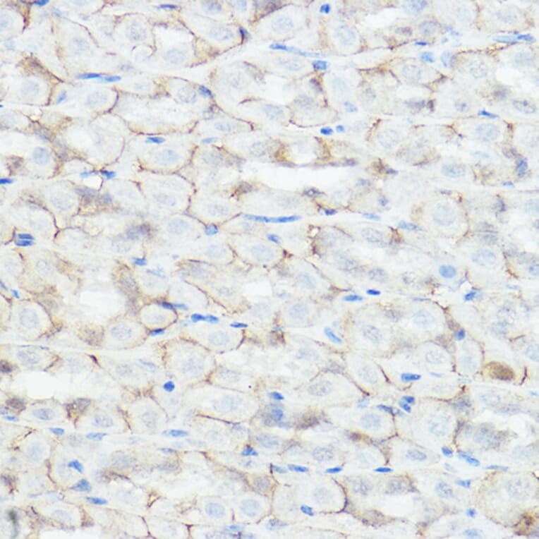 Immunohistochemistry - Anti-GABA A Receptor alpha 2/GABRA2 Antibody (A13667) - Antibodies.com