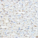 Immunohistochemistry - Anti-GABA A Receptor alpha 2/GABRA2 Antibody (A13667) - Antibodies.com