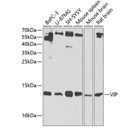 Western Blot - Anti-VIP Antibody (A13668) - Antibodies.com