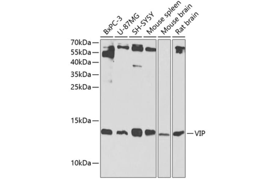 Western Blot - Anti-VIP Antibody (A13668) - Antibodies.com