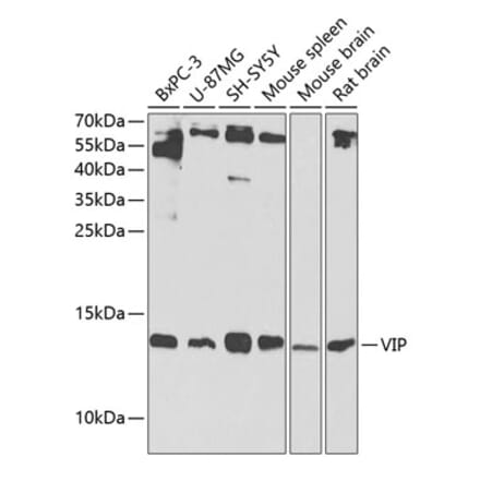 Western Blot - Anti-VIP Antibody (A13668) - Antibodies.com