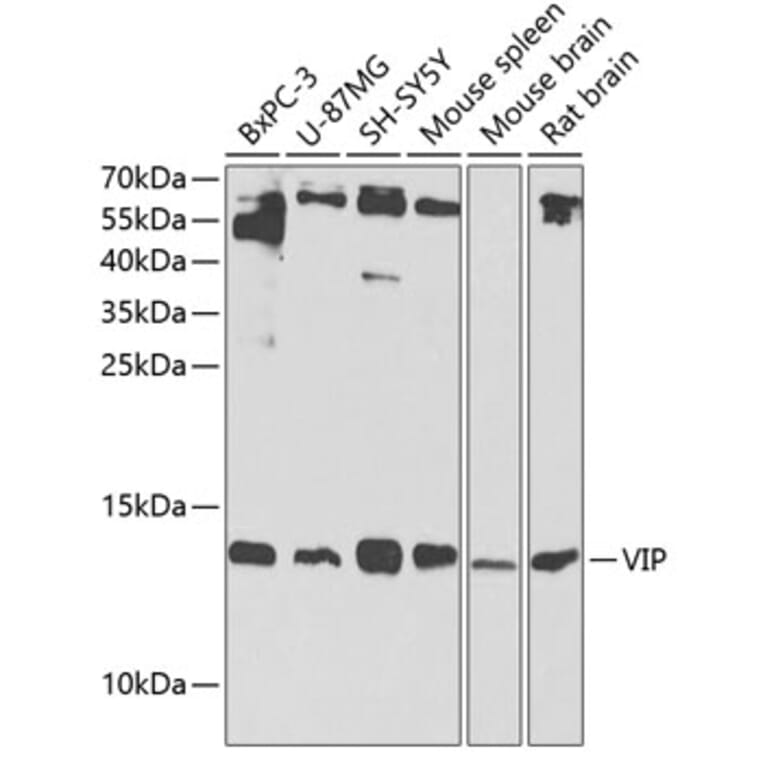 Western Blot - Anti-VIP Antibody (A13668) - Antibodies.com