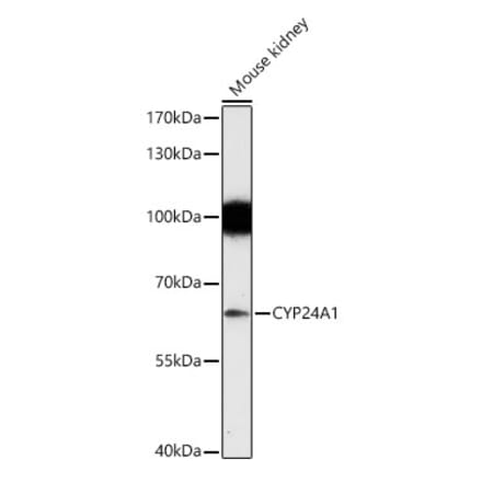 Western Blot - Anti-CYP24A1 Antibody (A13669) - Antibodies.com