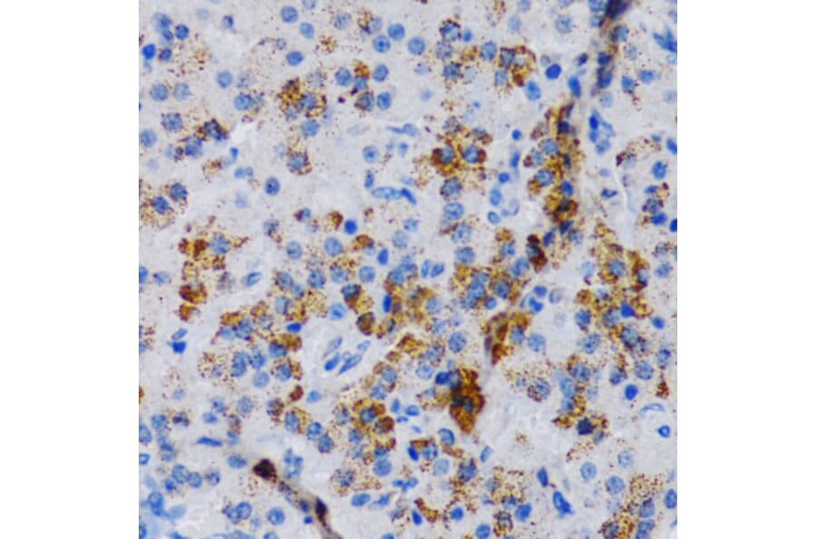 Immunohistochemistry - Anti-CYP24A1 Antibody (A13669) - Antibodies.com