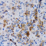 Immunohistochemistry - Anti-CYP24A1 Antibody (A13669) - Antibodies.com