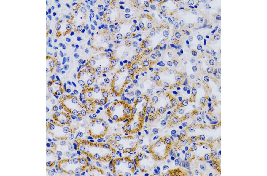 Immunohistochemistry - Anti-CYP24A1 Antibody (A13669) - Antibodies.com