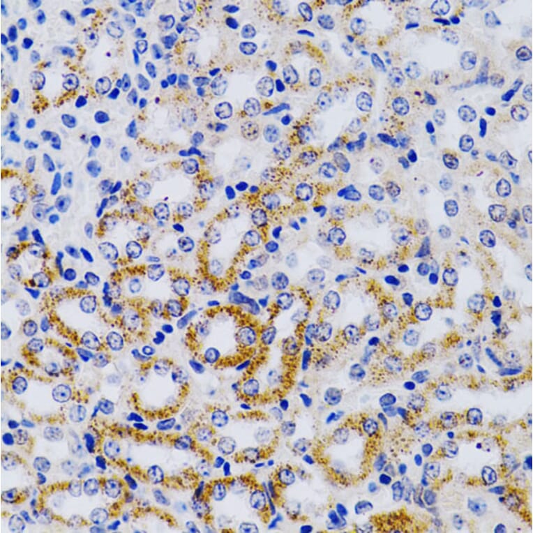 Immunohistochemistry - Anti-CYP24A1 Antibody (A13669) - Antibodies.com