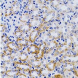 Immunohistochemistry - Anti-CYP24A1 Antibody (A13669) - Antibodies.com