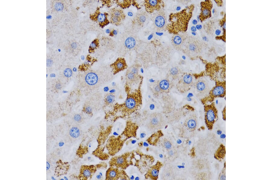 Immunohistochemistry - Anti-CYP24A1 Antibody (A13669) - Antibodies.com