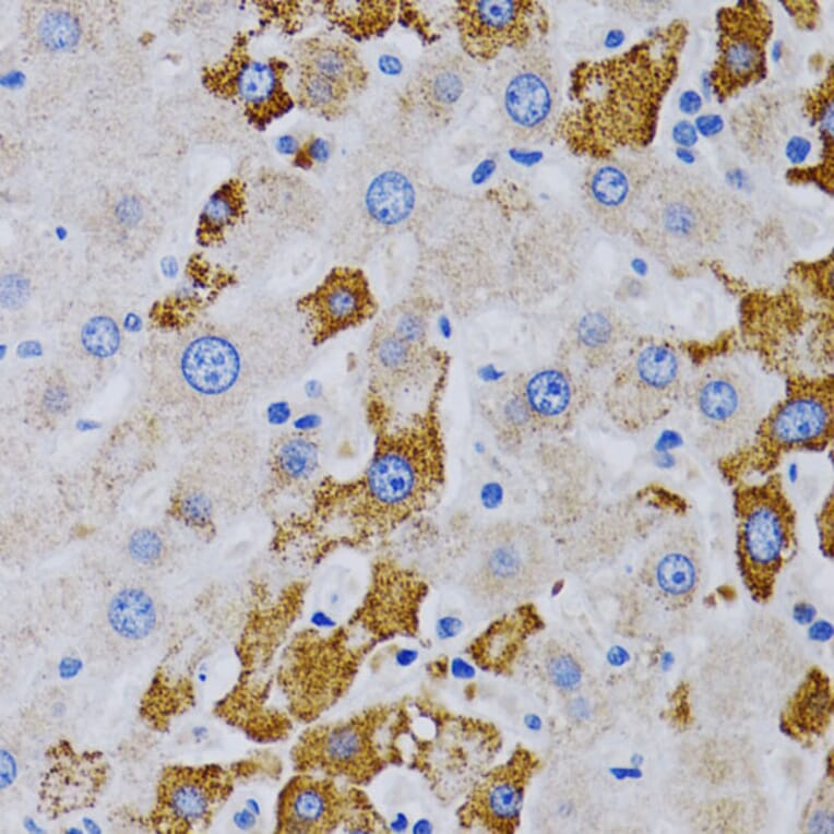 Immunohistochemistry - Anti-CYP24A1 Antibody (A13669) - Antibodies.com