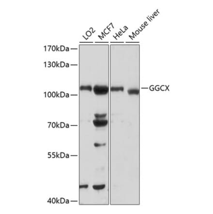 Western Blot - Anti-GGCX Antibody (A13670) - Antibodies.com