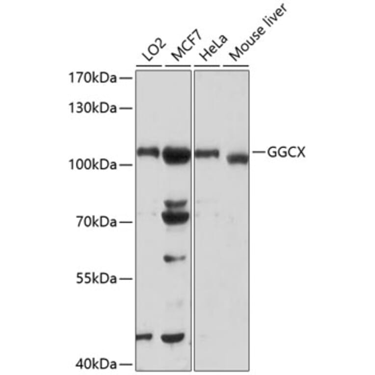 Western Blot - Anti-GGCX Antibody (A13670) - Antibodies.com