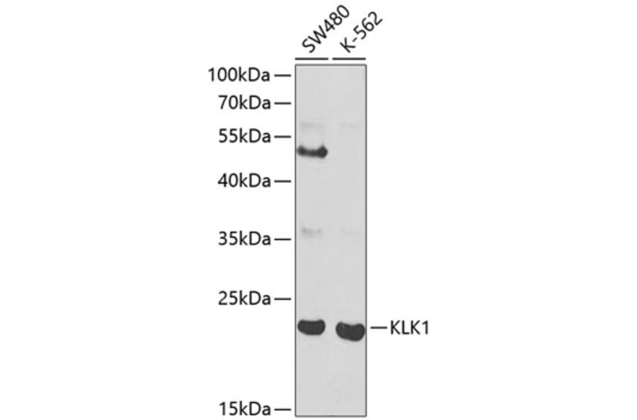 Western Blot - Anti-Tissue kallikrein Antibody (A13671) - Antibodies.com
